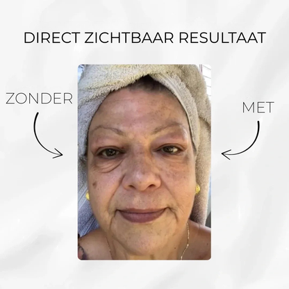 V-Lift™ – Verfijnende Oogverzorging