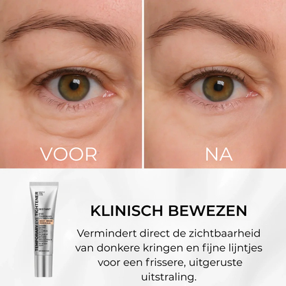 V-Lift™ – Verfijnende Oogverzorging