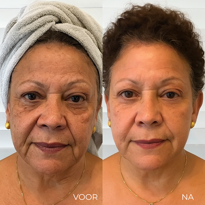 V-Lift™ – Verfijnende Oogverzorging